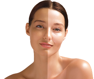 Pomáhá vyrovnat tón pleti a rozjasnit pleť